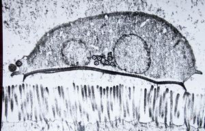 Giardia (lamblia) intestinalis